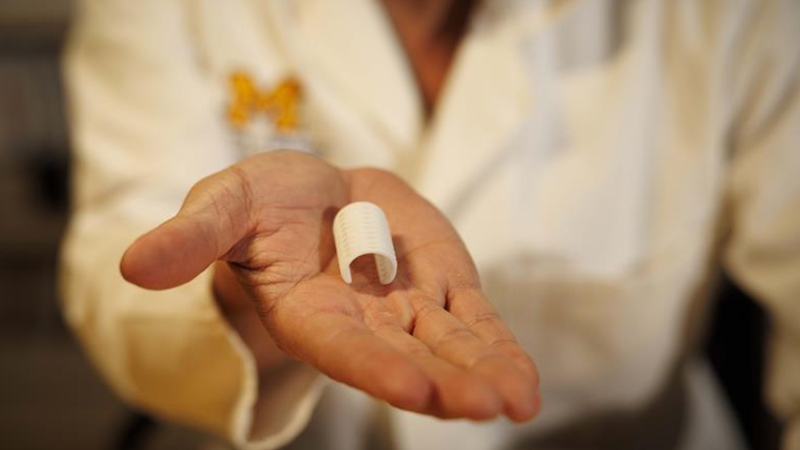 a hand holding one of the 3D-printed bioresorbable devices